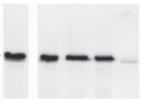 OLE2 | Oleosin 21,2 kDa in the group Antibodies Plant/Algal / Plant Developmental Biology / Plant Signal Transduction at Agrisera AB (Antibodies for research) (AS20 4411)